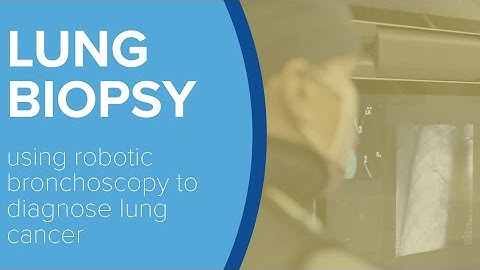 Robotic Bronchoscopy for Lung Biopsy - Yale Medicine Explains