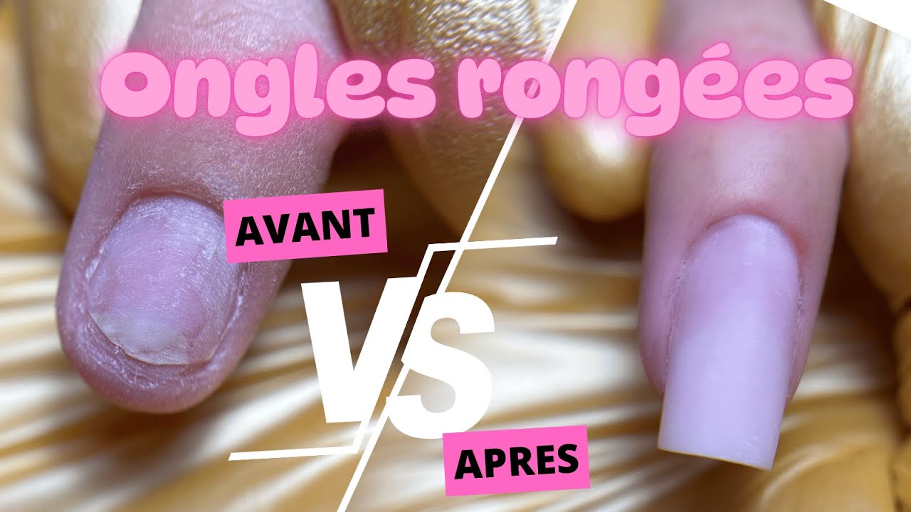 Reconstruction EXTREME d'un ongle rongé - TECHNIQUE PROFESSIONNELLE !