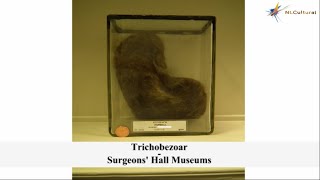 Trichobezoar at The Surgeons&#39; Hall Museums