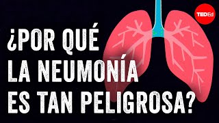 ¿Por qué la neumonía es tan peligrosa?  Eve Gaus y Vanessa Ruiz