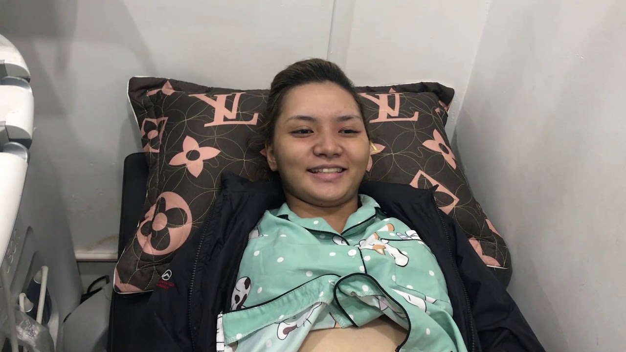 Siêu âm thai 12 tuần 3 ngày - khoảng sau gáy 1mm... - youtube