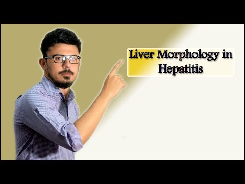 Liver Morphology in Hepatitis Part 10 in Liver pathology