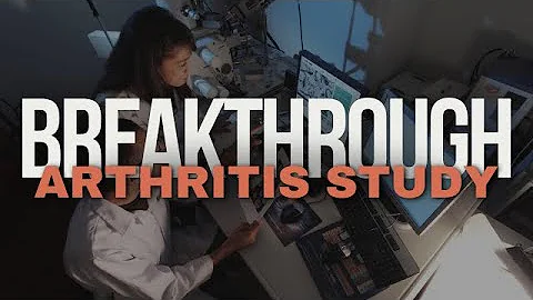 Psoriasis and Joint Pain: New Insights on Psoriatic Arthritis from Groundbreaking Study