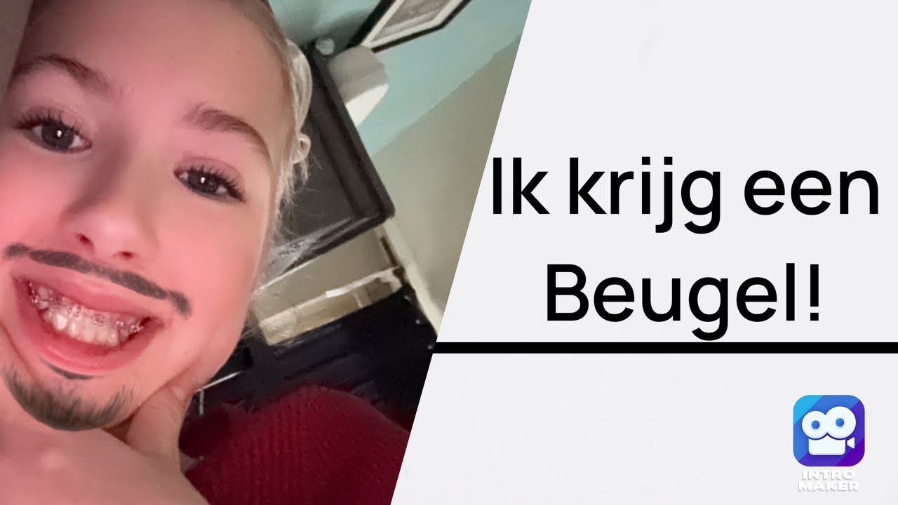 Beugelvlog!!!😔 // + 2dagen updates (let er niet op hoe ik eruit zie ik