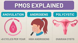PMOS (PCOS) Explained | Polyendocrine Metabolic Ovarian Syndrome