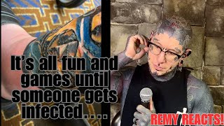 Remy reacts to Tattoo Infection!