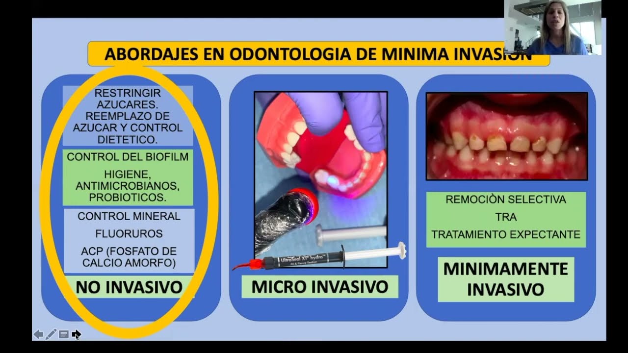 Odontología de Mínima Intervención