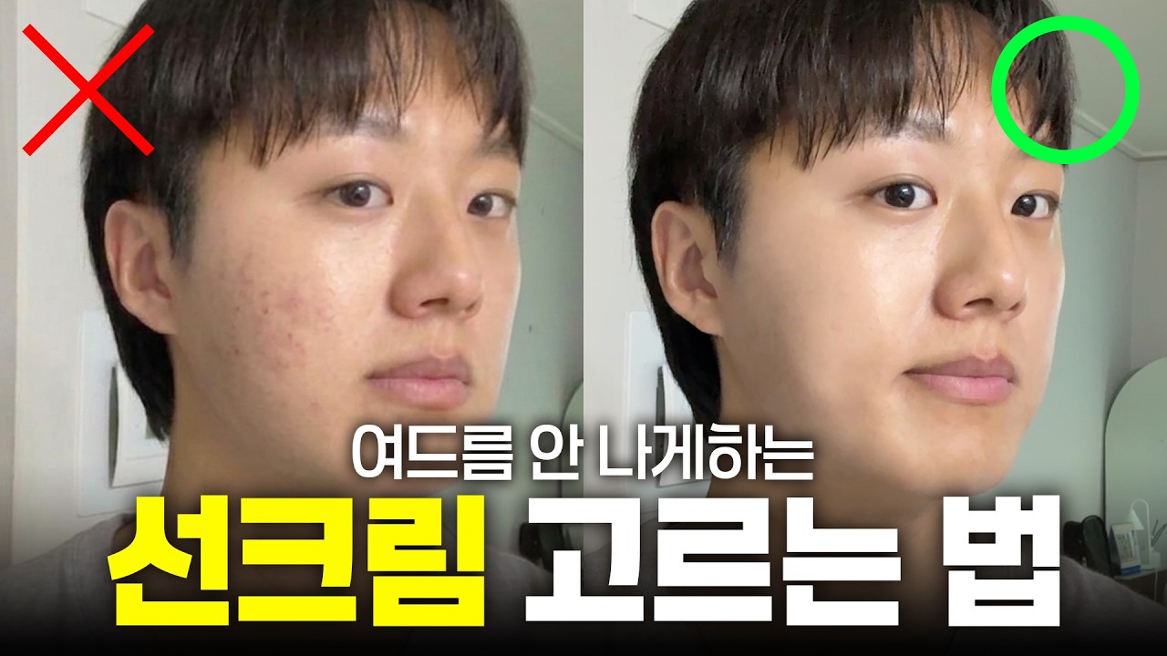 (광고❌) 선크림만 바르면 여드름 올라왔던 분들 필수시청..!