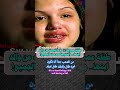 أصغر أم طفلة عمرها 12 عاما تبحث عن والد ابنها والنتيجة صدمت الجميع