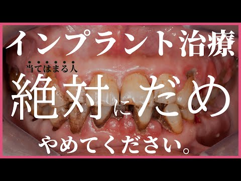 インプラント絶対だめ!な人の特徴。「やらなきゃよかった」「やめたほうがいい」と失敗後悔しないために・・・
