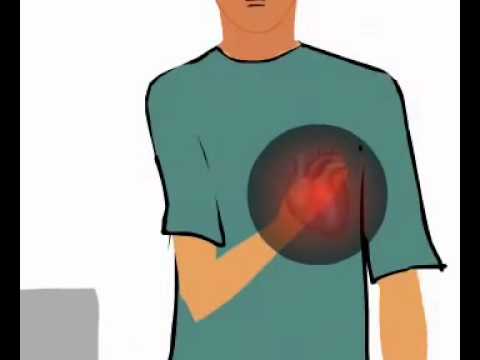 Ишемическая болезнь сердца