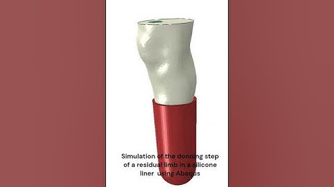 Donning step of silicone liner in residual limb using Abaqus #abaqus #fem #xfem