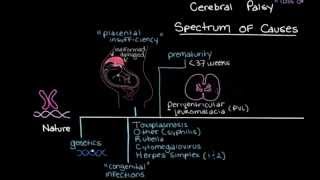 Khan Academy - What is Cerebral Palsy & What Causes it?