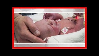 NEWS 24H - The first baby from a uterine transplant in the U.S. born in dallas