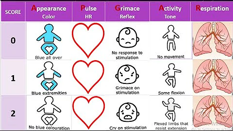 Apgar Score Assessment # newborn Apgar Score