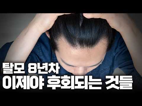 탈모 8년차, 이제야 후회되는 몇가지