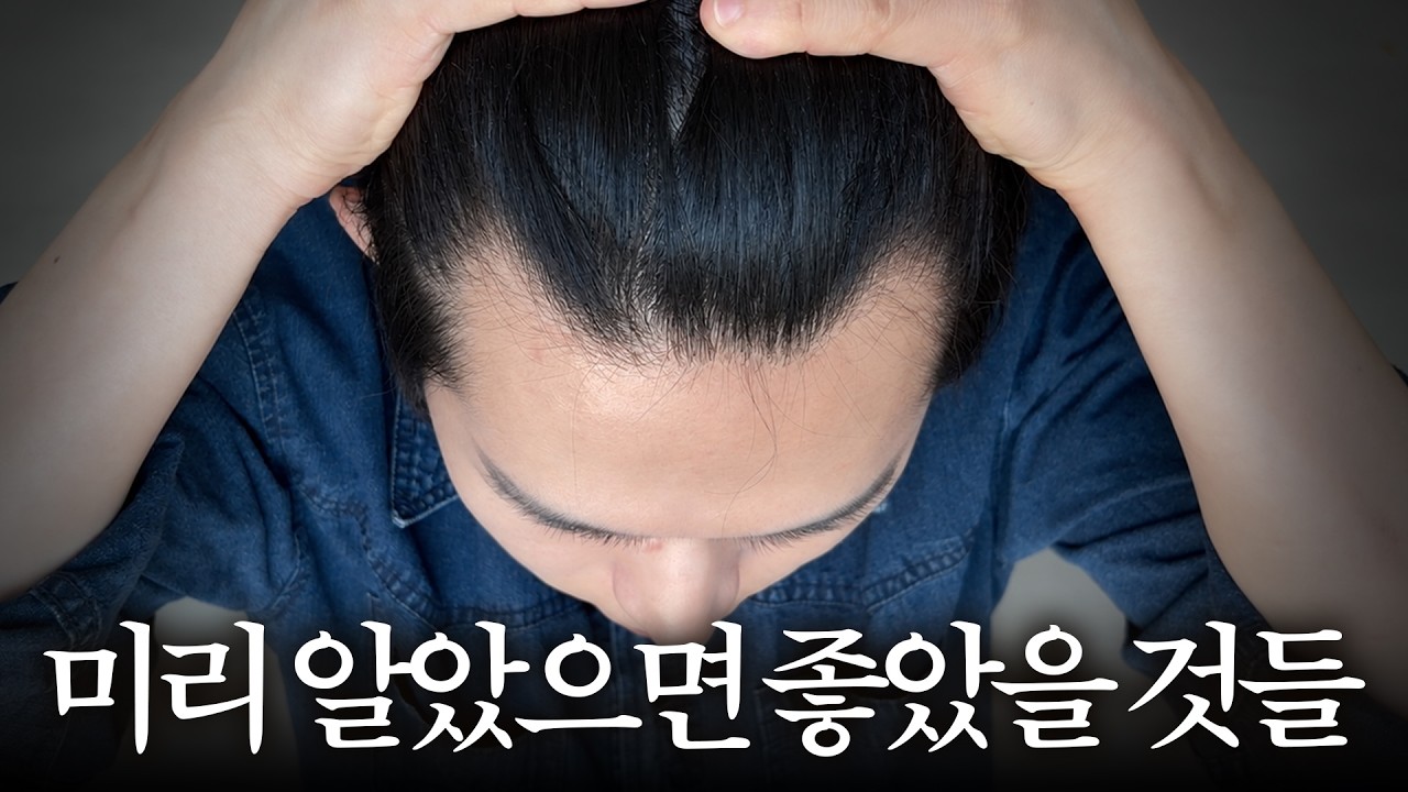 탈모 8년차, 미리 알았으면 좋았을 것들 thumbnail