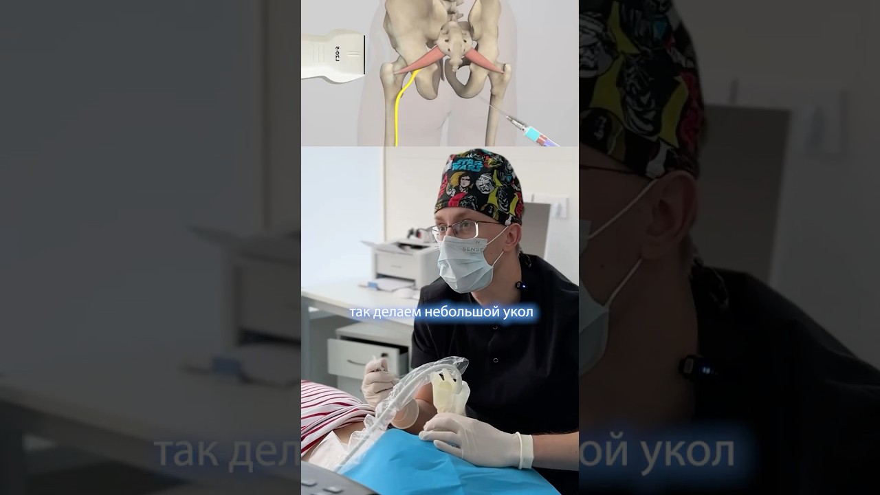 Блокада грушевидной мышцы с ультразвуковым контролем