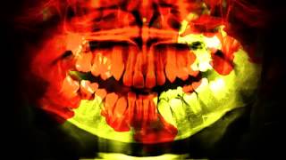 Download Lagu Fatality - \ MP3