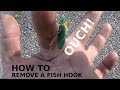 OUCH! How To Remove A FISHING HOOK In The Field - EASY FISH HOOK REMOVAL