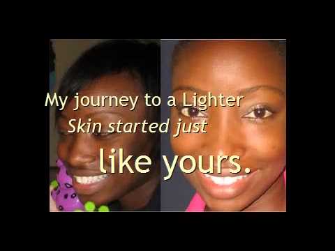 Skin Whitening Lotion? I found a better way! - YouTube