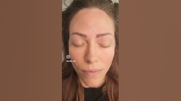 Before and After Nanobrows
