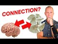 The bone health brain health and breast cancer connection  what you were never told