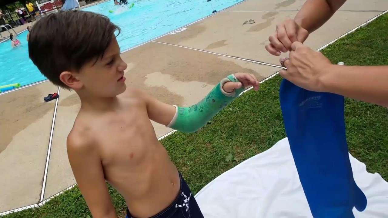 Alec swimming with waterproof cast cover YouTube