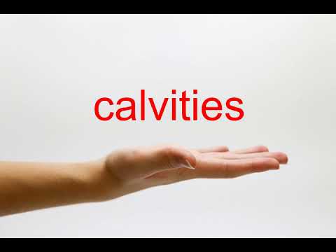 How to Pronounce calvities - American English