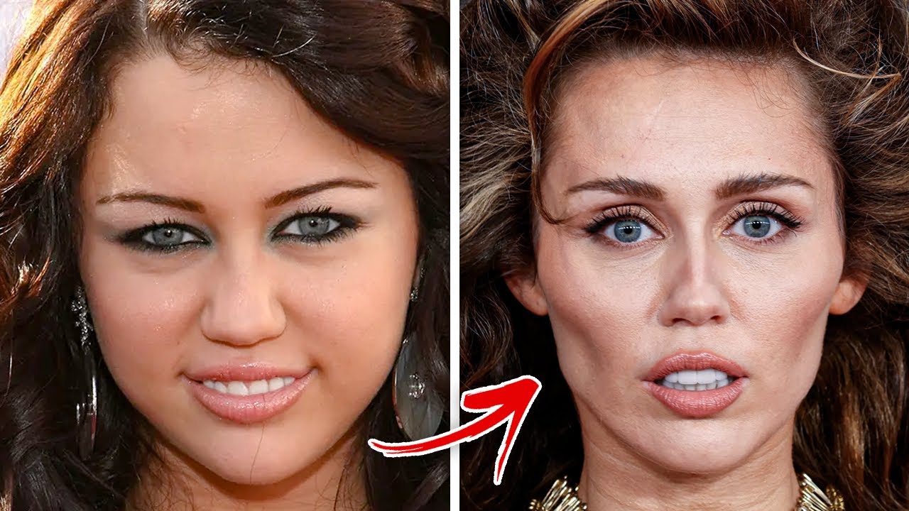Celebrities Who Regret Their BOTCHED Plastic Surgeries YouTube