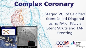 Staged PCI of Calcified Stent Jailed Diagonal using RA or IVL via Stent Struts and TAP Stenting