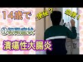 【潰瘍性大腸炎】＃１　14歳で　潰瘍性大腸炎に　初期症状