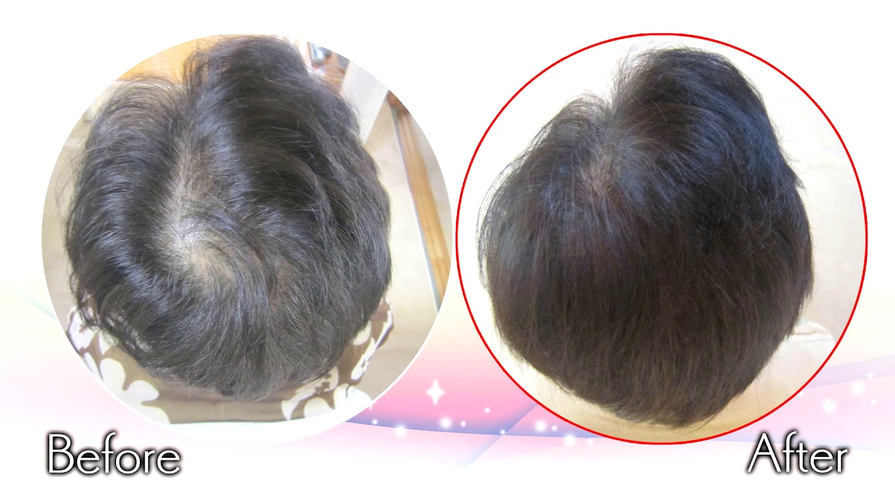 1GX 4 DP ヘアエクステンション 18 20 55.9 cm 50g ヘア