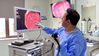 Qastroenteroloq-Hepatoloq, Endoskopist Dr. Rövşən İbi̇şov Artıq Avrasi̇ya Hospi̇talda