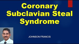 Coronary Subclavian Steal Syndrome