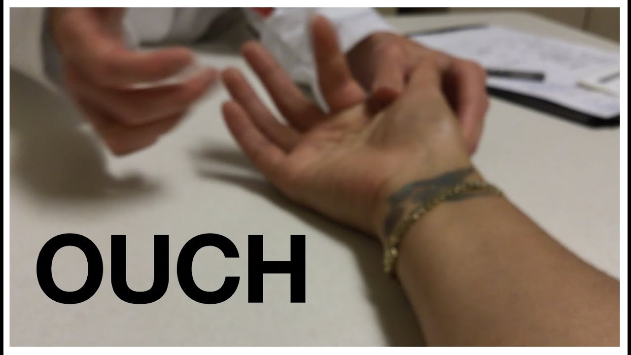 Ep.  6 Off to the Hand Surgeon