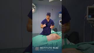 Cirugía plástica de lipoescultura con marcación abdominal