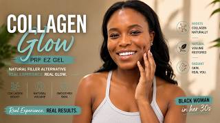 PRF EZ Gel Natural Filler Alternative on Black Woman in Her 30s: Collagen Boost Experience