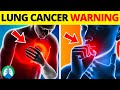 Top 10 Early Warning Signs of Lung Cancer | NEVER IGNORE THIS Mp3 Song