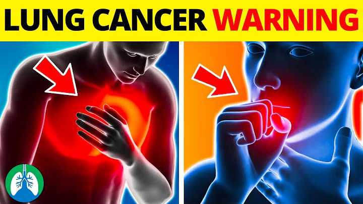 Top 10 Early Warning Signs of Lung Cancer to Look For ⚠️ - DayDayNews