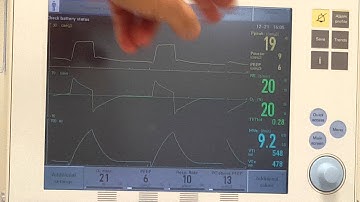 Skill 9h k PC Automode