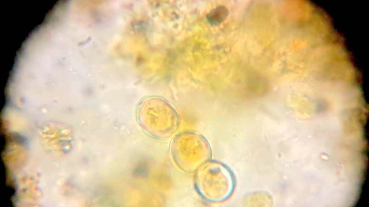 Copy of Bird bath helical bacteria YouTube