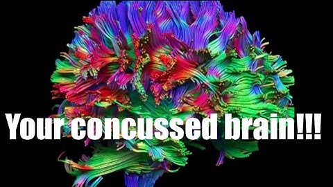 Concussions and post-concussion syndrome