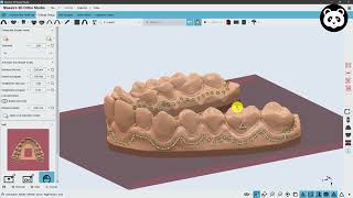 Maestro 3D | Dental Studio | Automatic aligner trimming