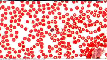 Scanning a Slide with the uScopeMXII