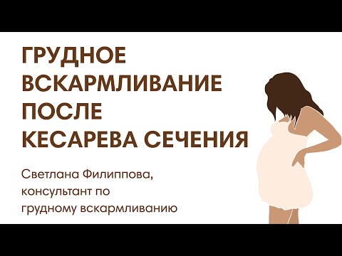 ГРУДНОЕ ВСКАРМЛИВАНИЕ ПОСЛЕ КЕСАРЕВА СЕЧЕНИЯ