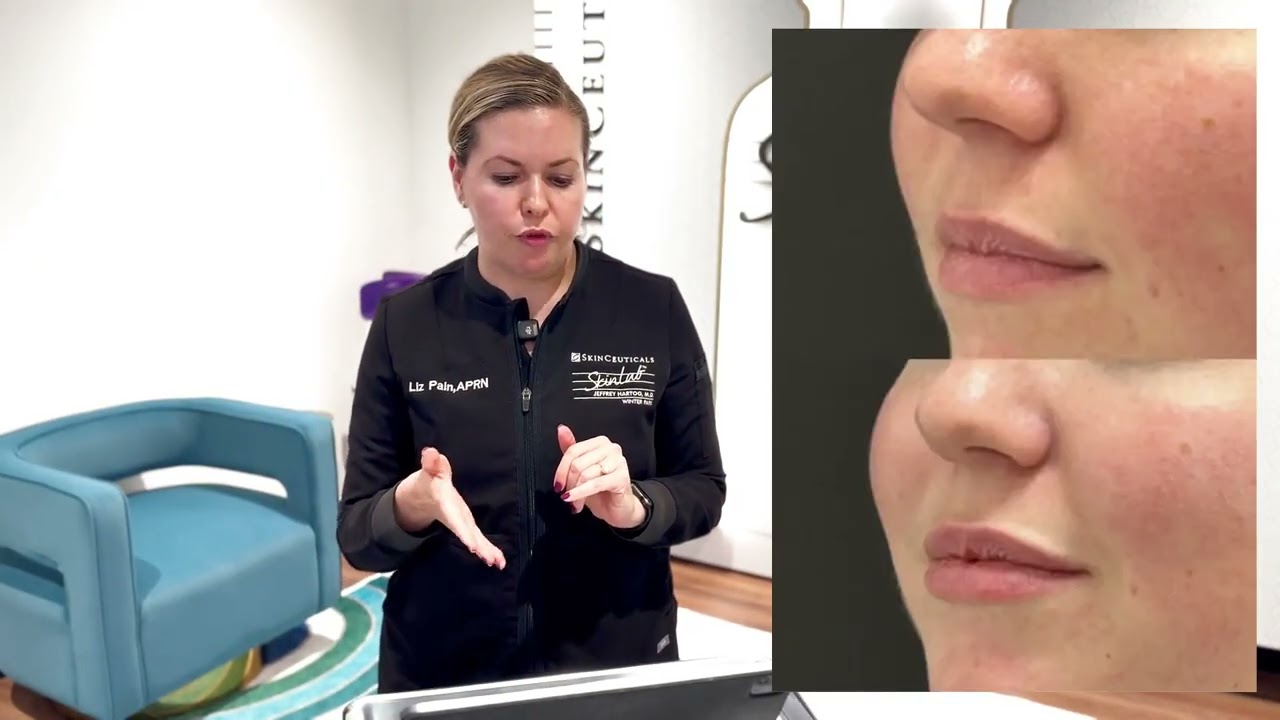 Subtle is the New Stunning, Achieving Natural Results with Modern Dermal Fillers with Liz Pain, APRN