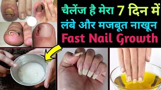 5 दिन में हाथों के नाख़ून बढ़ाने और मज़बूत करने का घरेलू उपाय | Nakhun Badhane Ka Tarika | Grow Nails