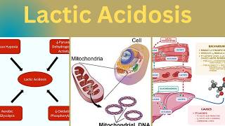 Lactic Acidosis- A practical approach