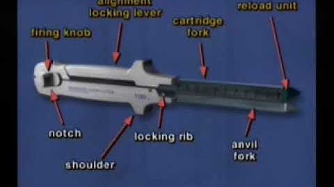 linear stapler- learn surgery